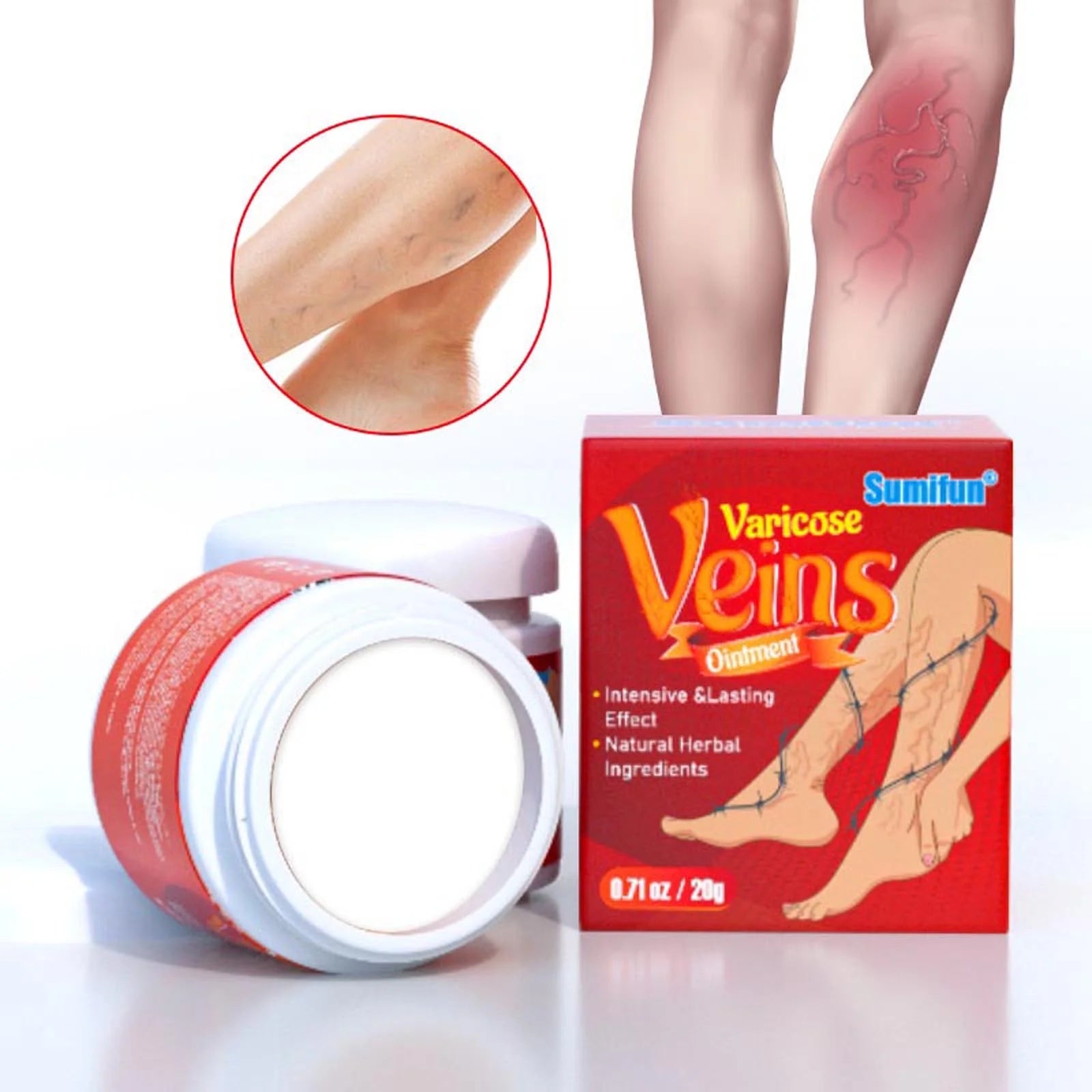 Varicose veins crema para varices