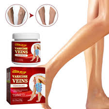 Varicose veins crema para varices